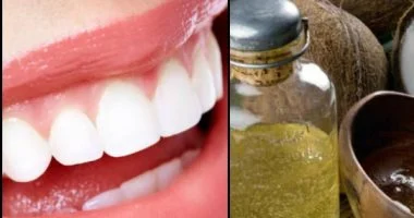 طرق طبيعية لتخفيف التهاب الأسنان