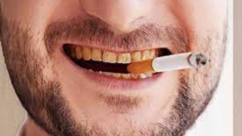 جفاف الفم وأعراضه