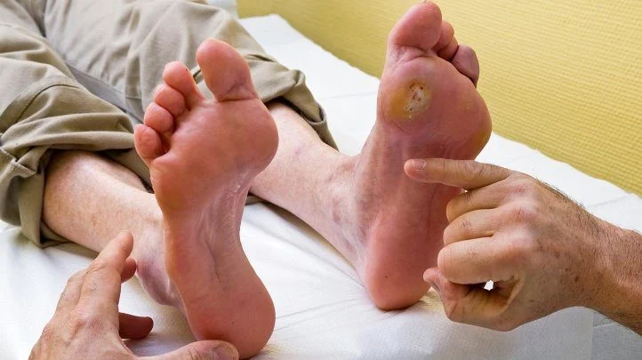 أسباب انسداد الأوعية الدموية في القدم