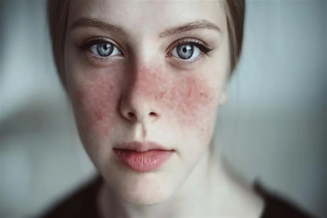 أمراض تصيب النساء بمعدلات أعلي من الرجال