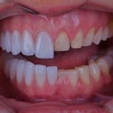 دكتورة ايثاتيكا لجراحه وتجميل الاسنان أخصائي اسنان في 6 اكتوبر
