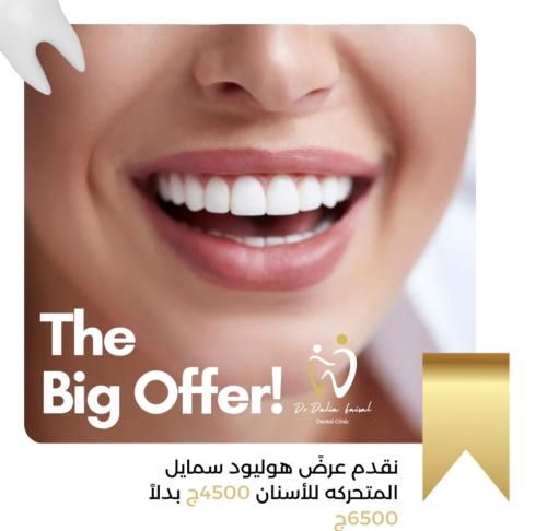 هوليود سمايل المتحركه للفكين Snap on Smile