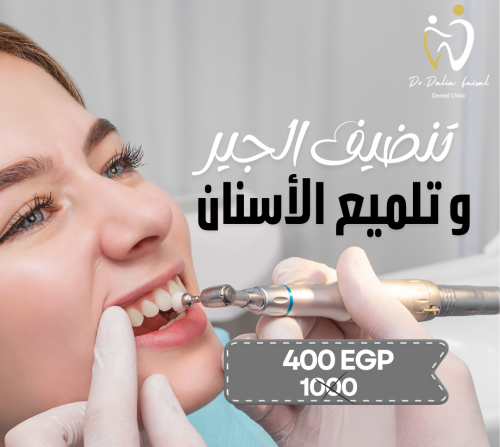 تنضيف الجير و تلميع الأسنان