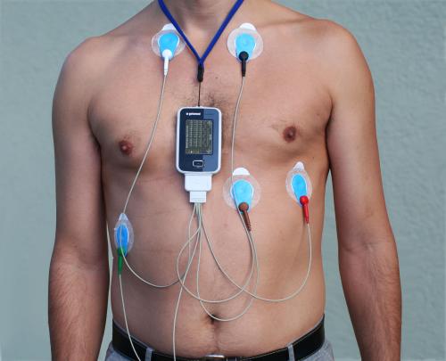 هولتر قلب ٤٨ ساعة Holter monitor