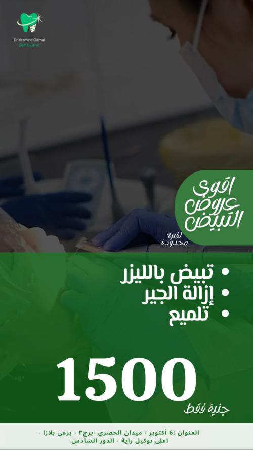 عرض تبييض الاسنان