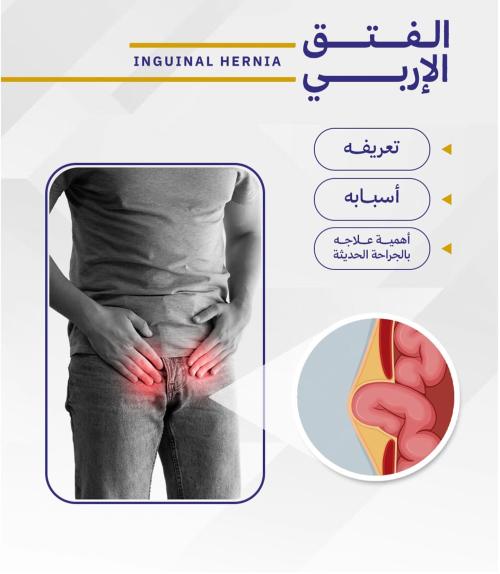 اصلاح الفتق الاربي جراحيا مع تركيب شبكه