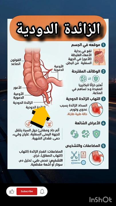 استئصال الزائدة الدودية جراحيا