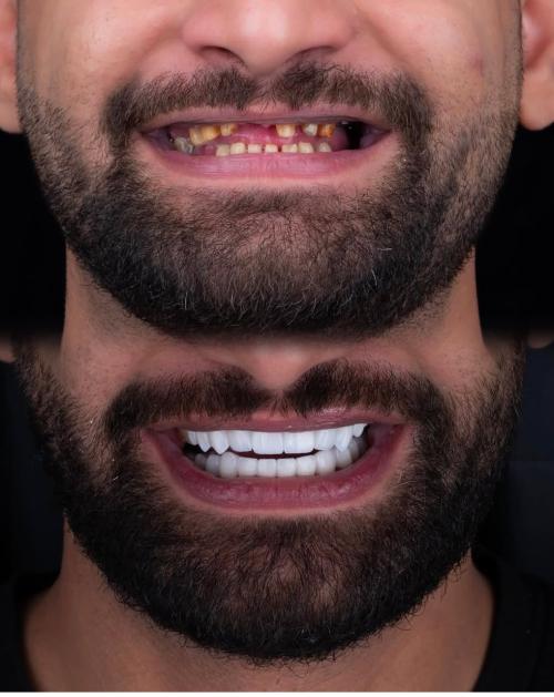التركيبات التجميليه