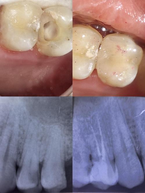 خصم 20٪ على جميع خدمات العيادة الخاصة بالاسنان .