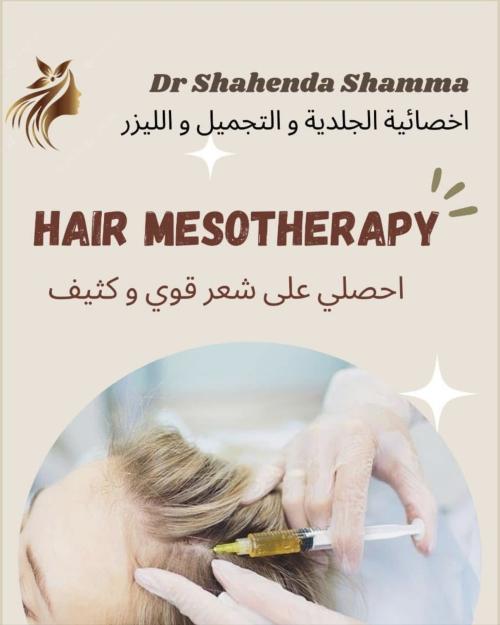 جلسات حقن ميزوثيرابي لعلاج تساقط الشعر و الصلع الوراثي