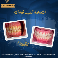 استشاري تركيبات صناعية وعلاج الجذور
