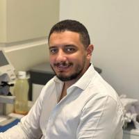 طب و جراحة العيون جامعة عين شمس - زراعة القرنية و ازالة المياه البيضاء و تصحيح عيوب الابصار بالليزر