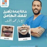 اخصائى طب وجراحة الفم وا لا سنان وتجميل الاسنان وزراعة الاسنان وأعاده بناء وتأهيل الفك الكامل