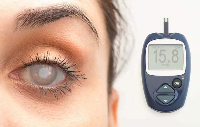 مرض السكر وتأثيره على العين