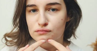 أخطاء شائعة تؤدي إلى نمو البكتيريا على الجلد