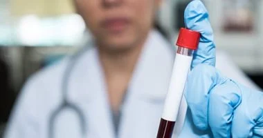 فيروس نيباه وأهمية الوقاية منه