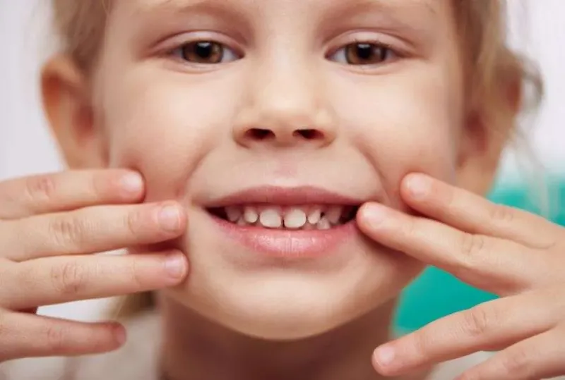 ماهو اللجام وأنواعه ؟