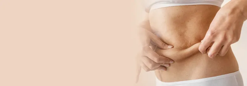 كل ما تحتاج معرفته عن عملية ربط المعدة