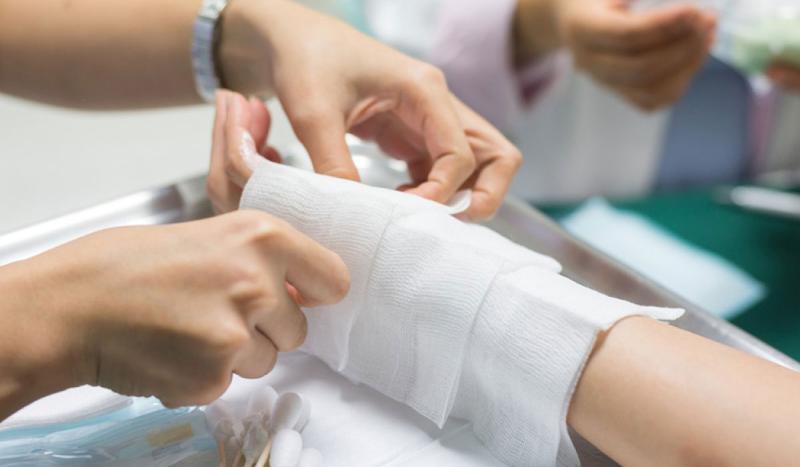 تعرف على مضاعفات الحروق والوقاية منها