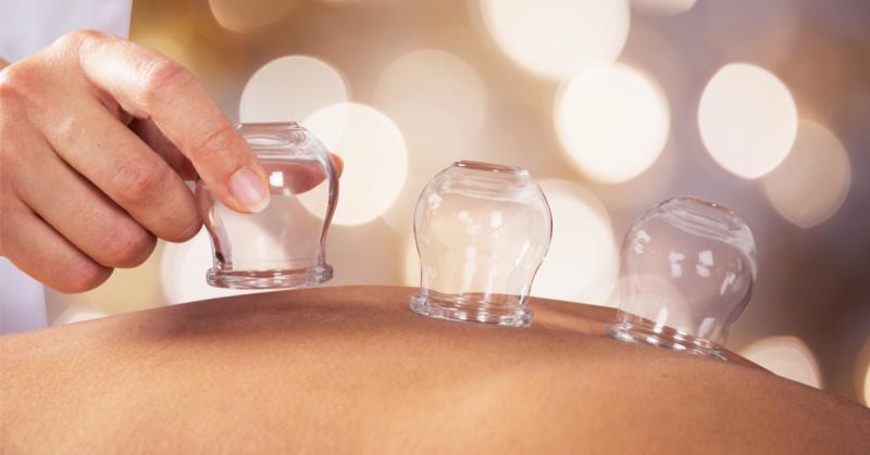 أنواع الحجامة ومعلومات هامة عنها