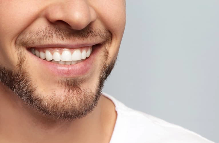 فوائد وأضرار ابتسامة هووليود