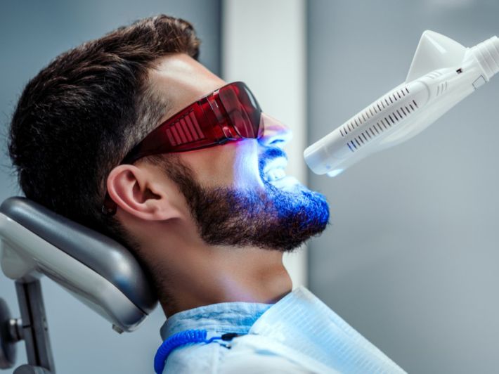 تبييض الأسنان بالليزر وأضراره