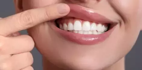 طرق تزيد من تقوية اللثة