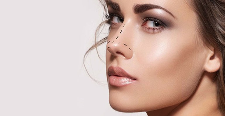 عملية تجميل الأنف والأسباب الشائعة لأجرائها