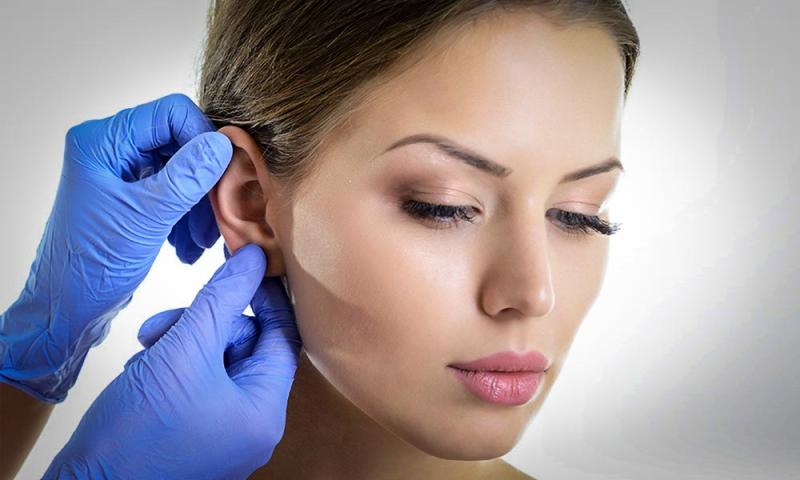 عملية تجميل الأذن وكل ماتحتاج معرفته عنها