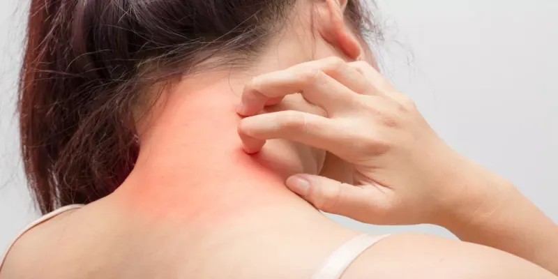 كيف تؤثر مضادات الهيستامين على الاستجابة المناعية للجسم ؟