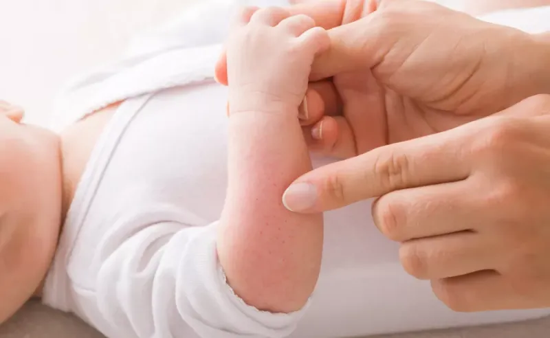 أسباب وجود حبوب حمراء على يد الأطفال