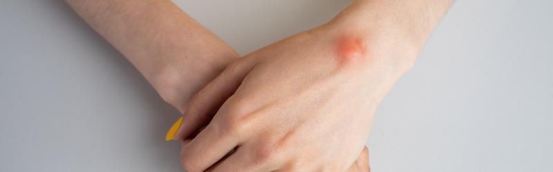 ورم النسيج اللين وأعراضه