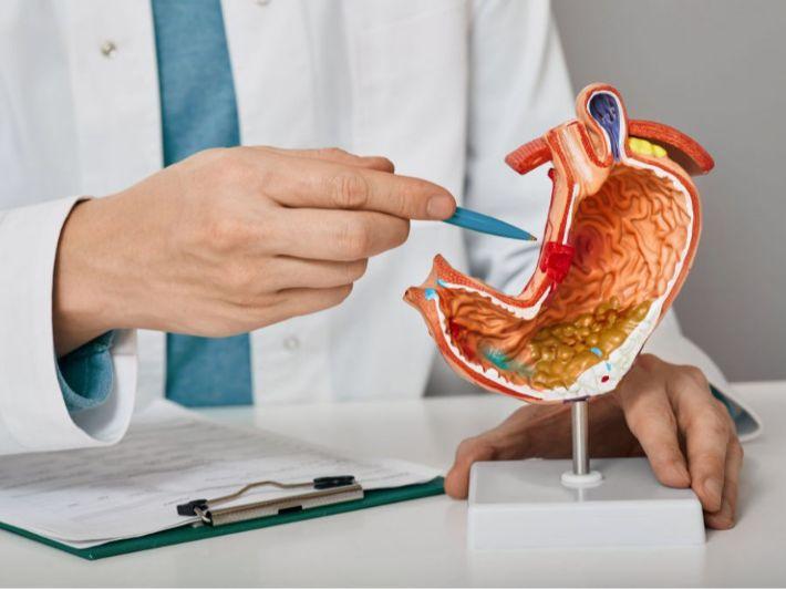 ارتخاء صمام المعدة والمشاكل التي يسببها