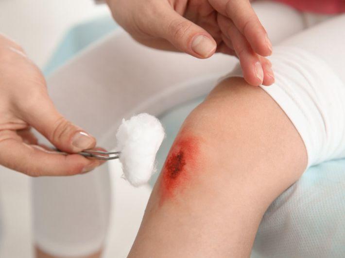 الجروح المتقيحة والملتهبة وكيفية التعامل معها