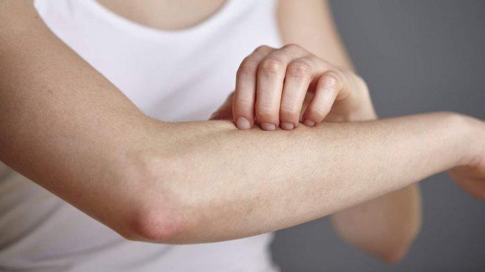 ماهو جلد الدجاجة وكيف يمكن معرفته ؟