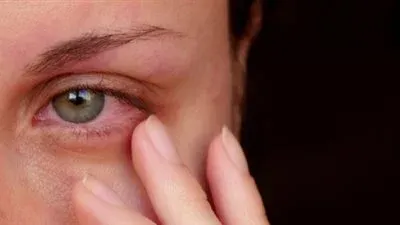 التهاب القزحية وتأثيره على العين