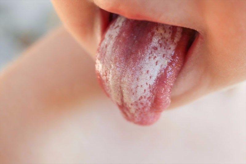 ما هي المبيضة البيضاء وكيف تؤثر على الجسم؟