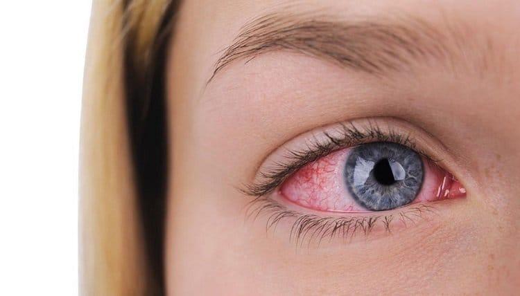 متي تعود الرؤية لطبيعتها بعد عملية المياه البيضاء ؟